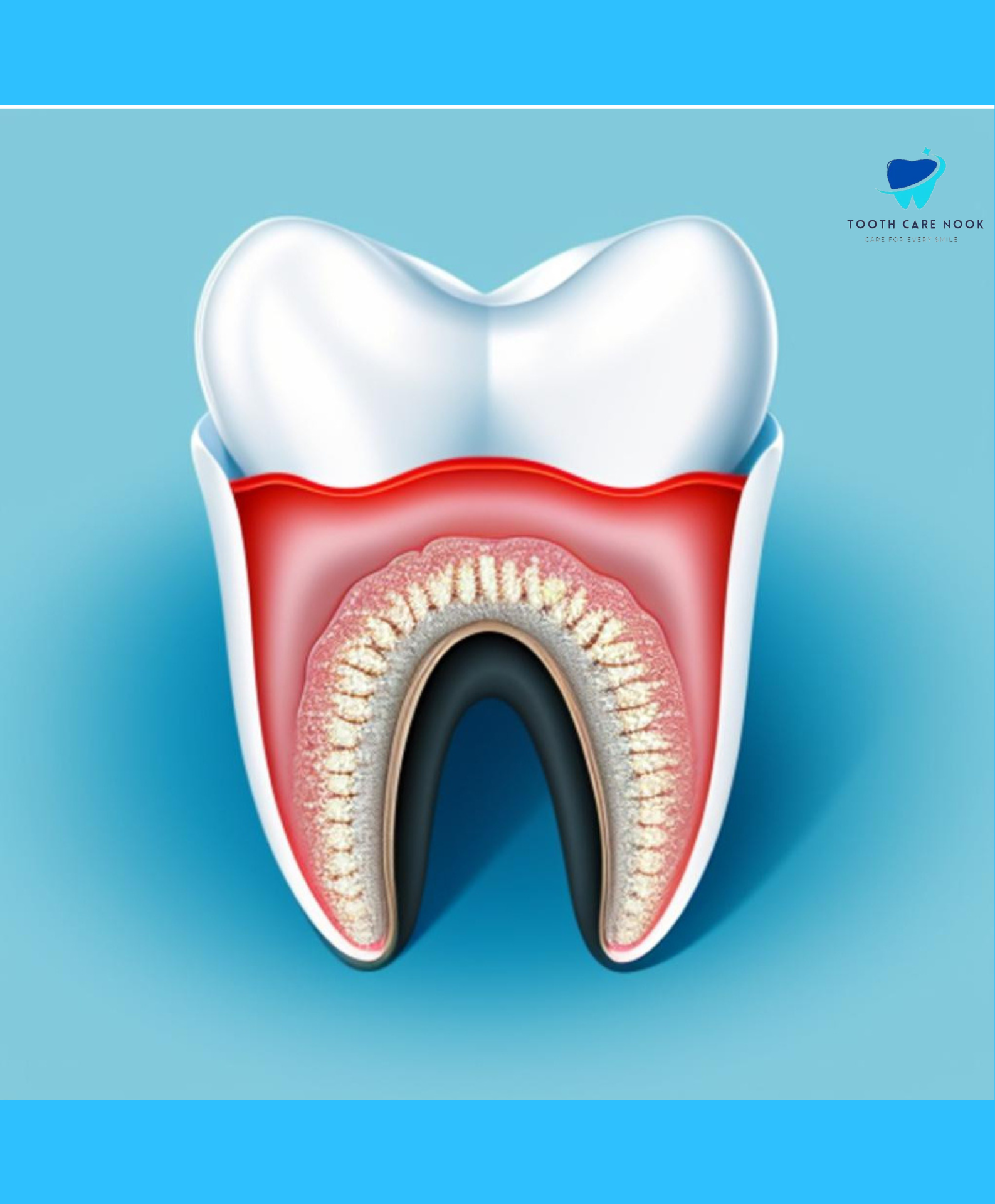 Tooth Abscess