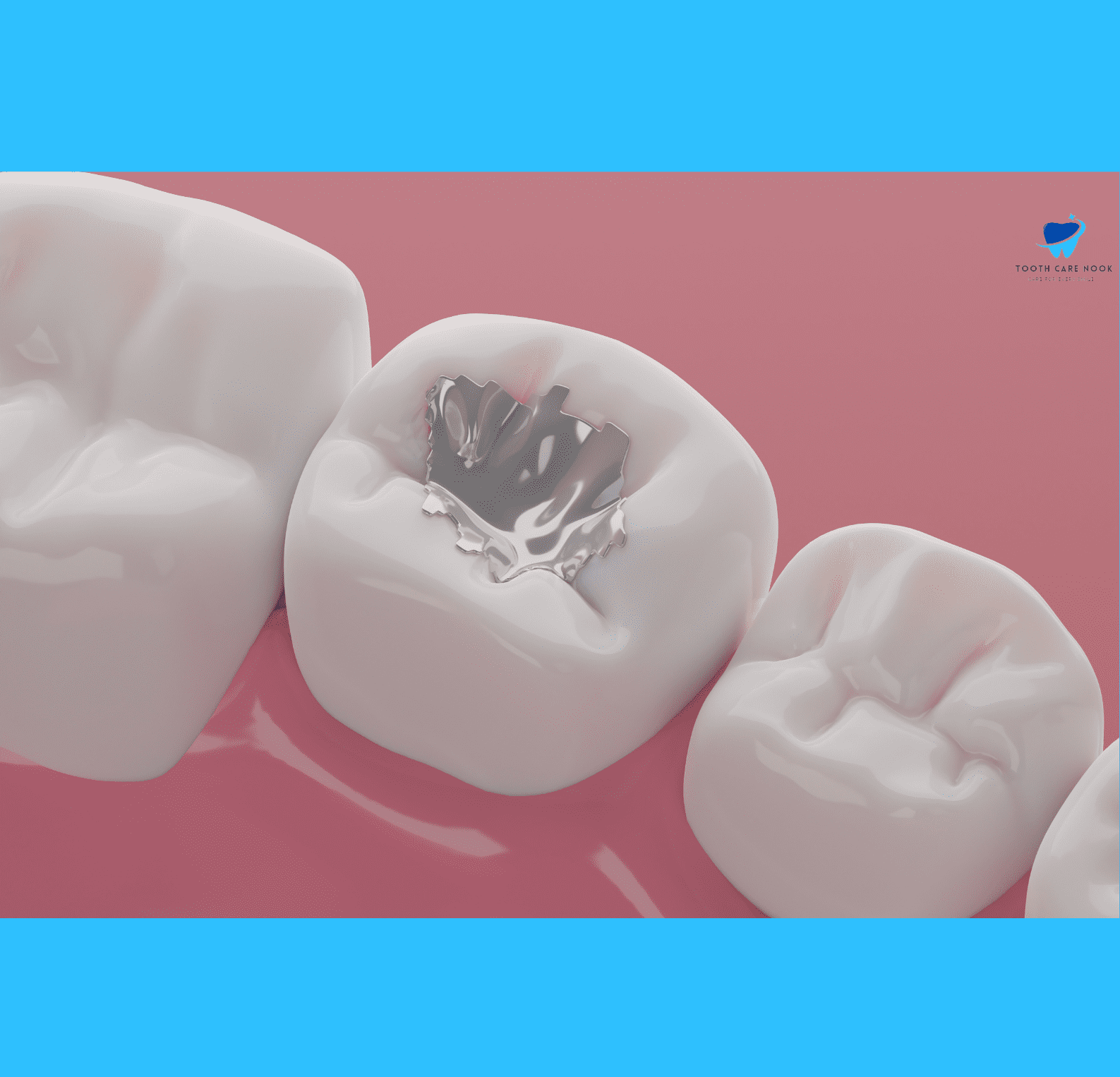 Dental amalgam