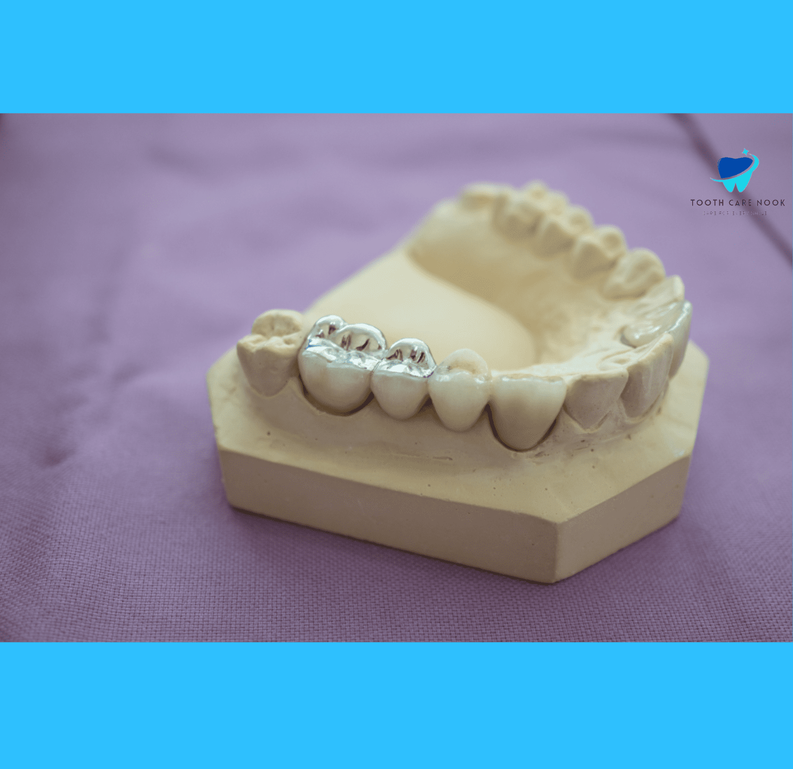 Reason of Cavity Formation on a Filling