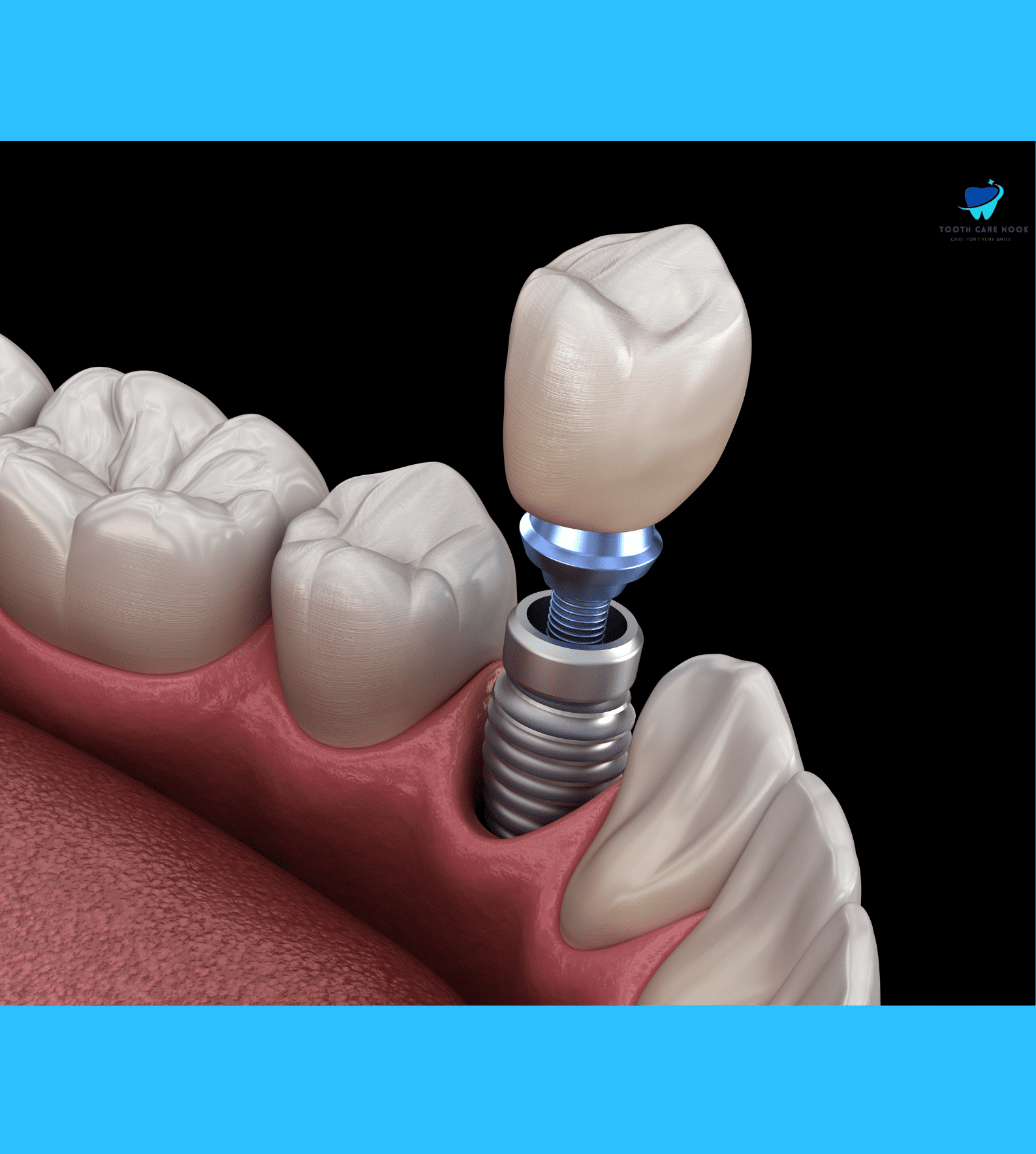 bicuspid