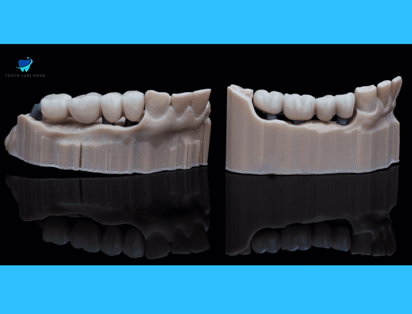 Bottom Teeth Dental Bridge: