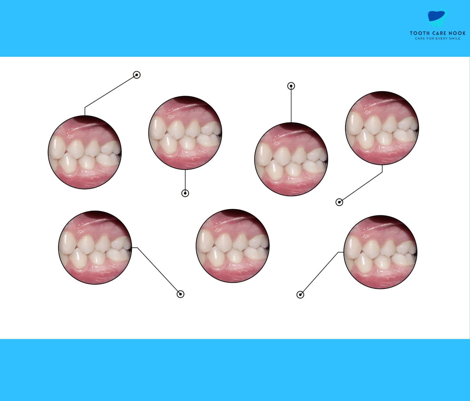 Dental Occlusion