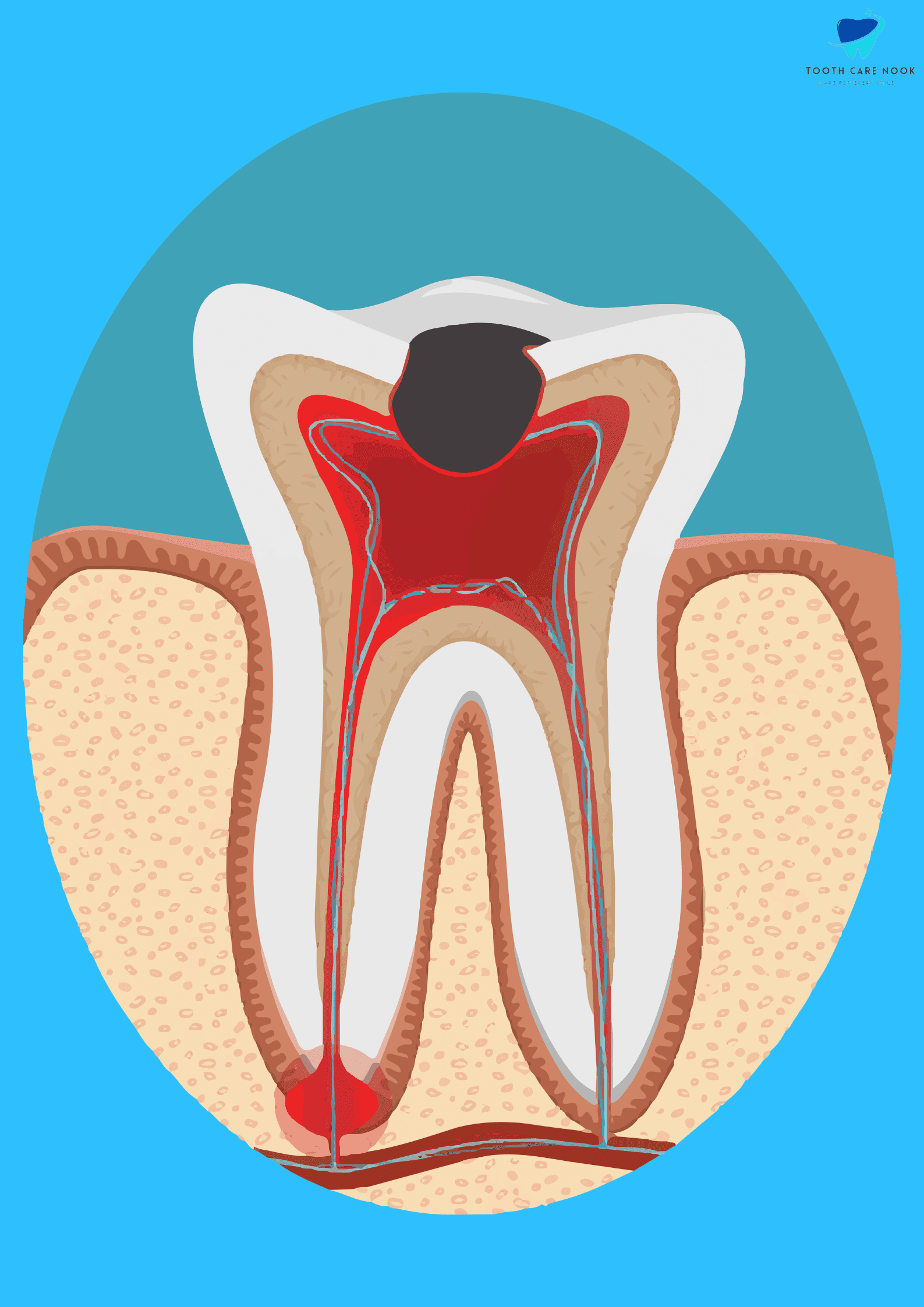 Dental endodontics