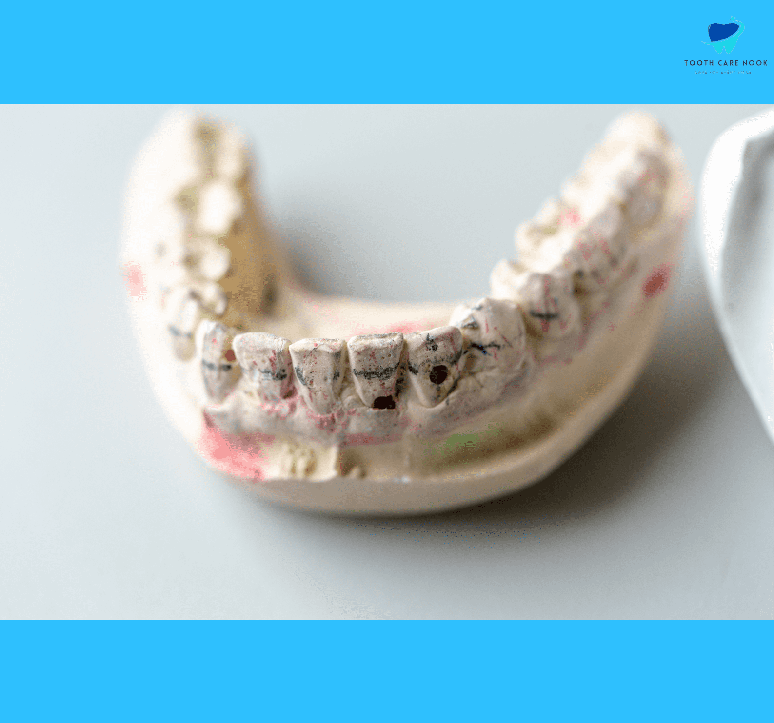 Dental Gypsum