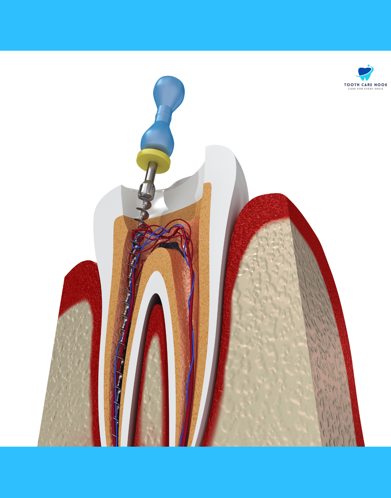 Number of Root Canals in a Single Day  