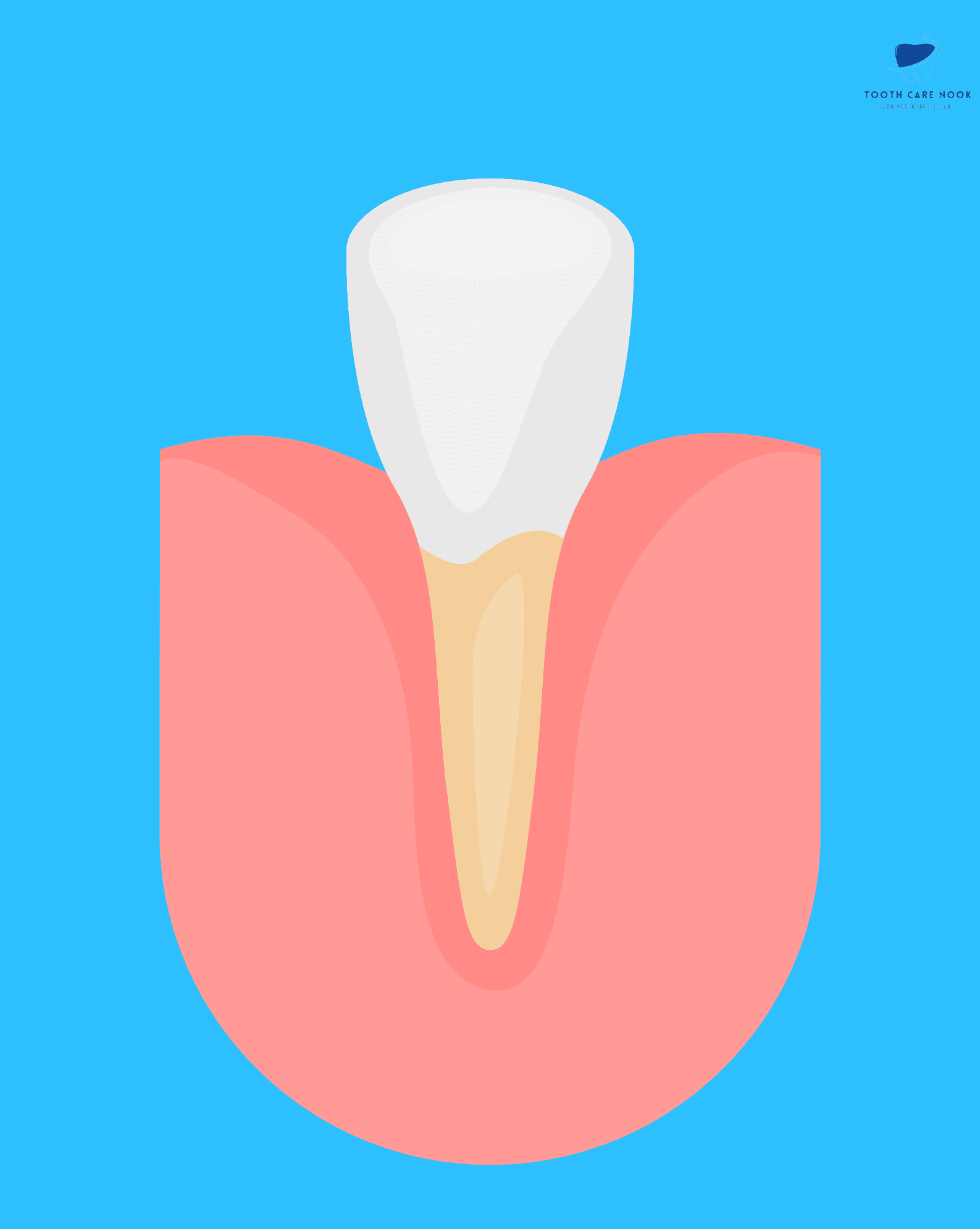 Incisors