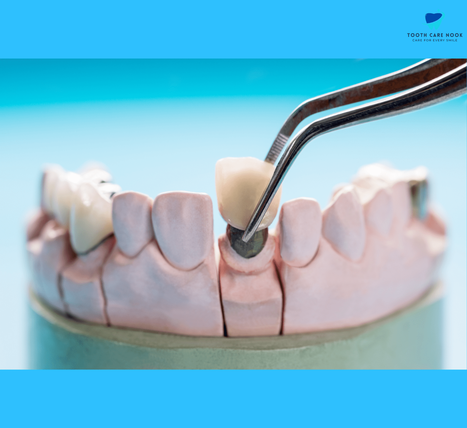 Prosthodontics