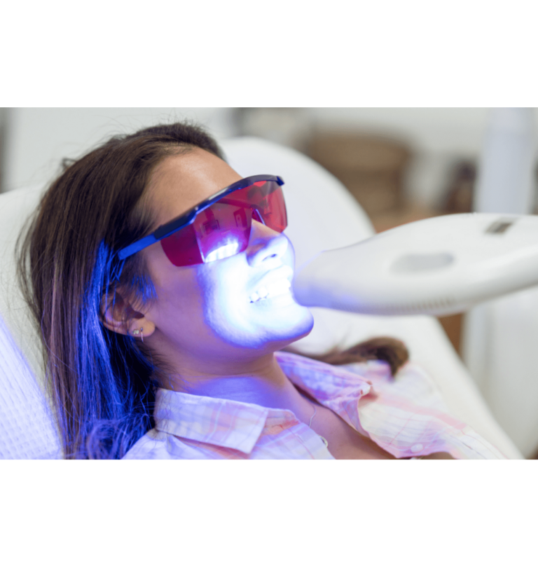 Laser Teeth Cleaning