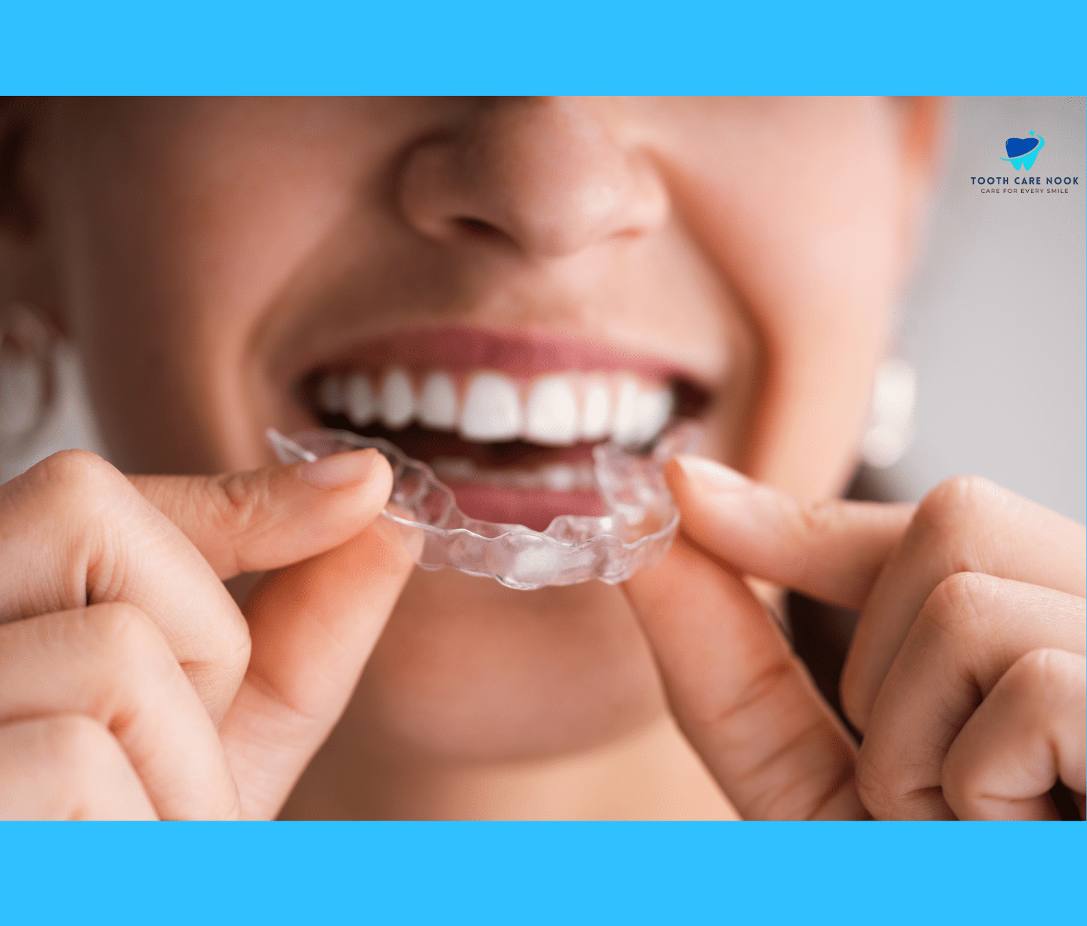 Clear Aligners 