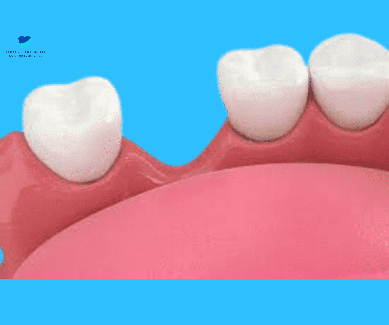 Dental Ridge Preservation