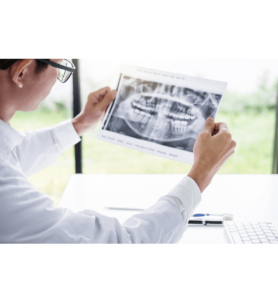 How Many Dental X-Rays Are Safe Per Year 