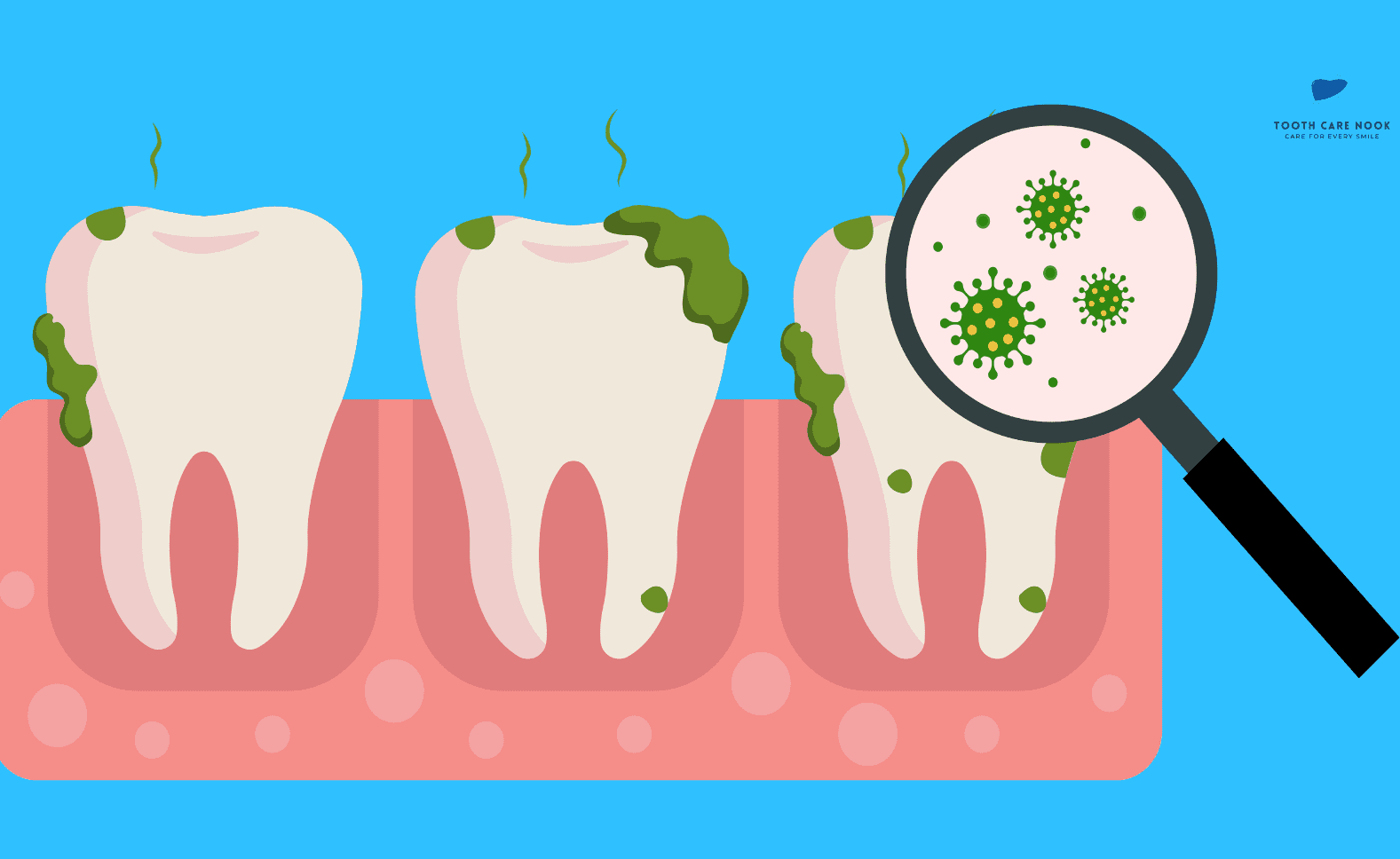 Bugs That Cause Gum Disease 