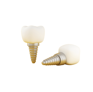 Can You Get Dental Implants While on Blood Thinners