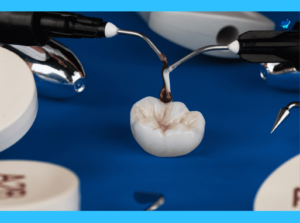 What Is Irm Dental? 