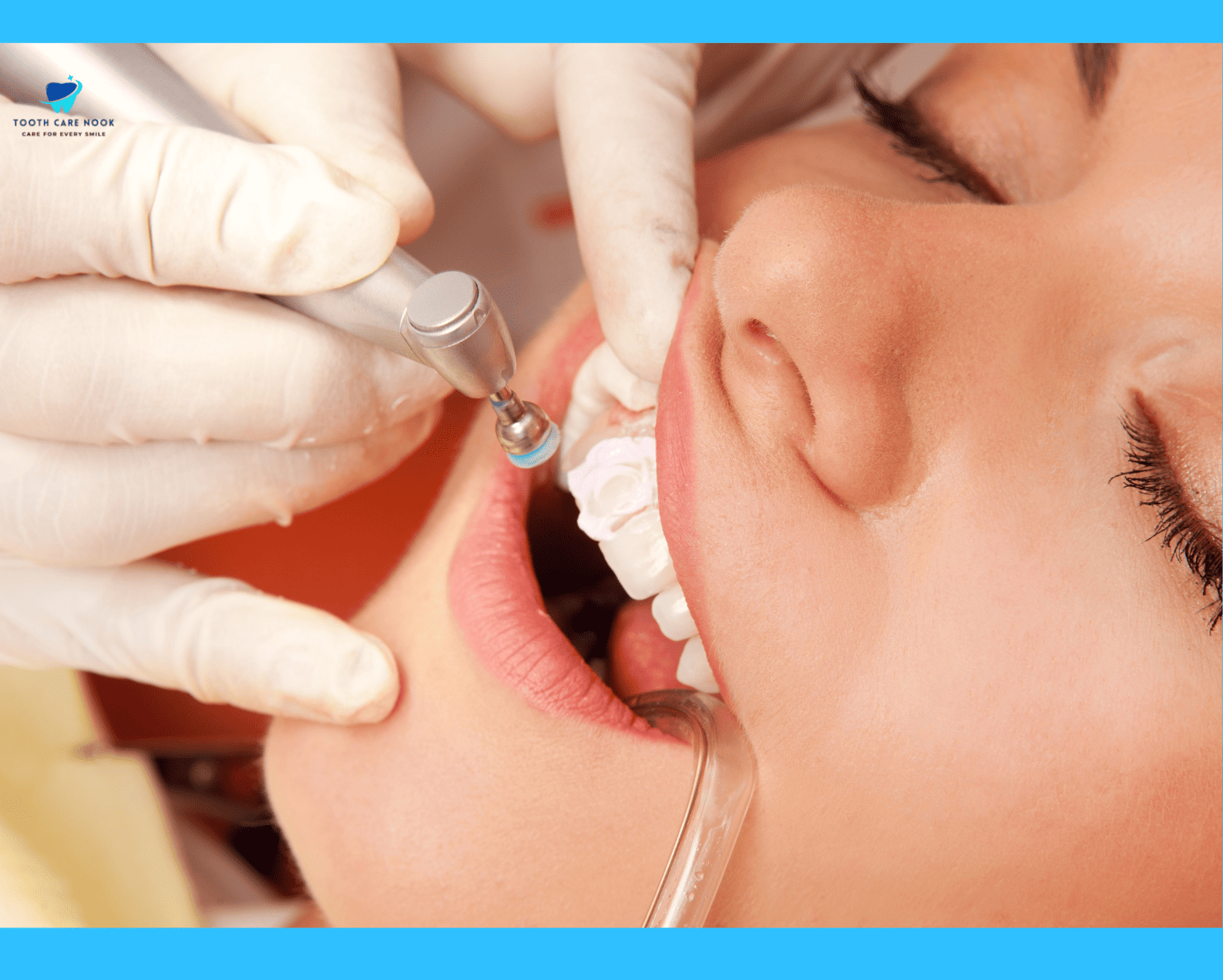 How To Treat Chipped And Flaking Teeth