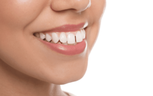 How to Fix Gaps in Front Teeth