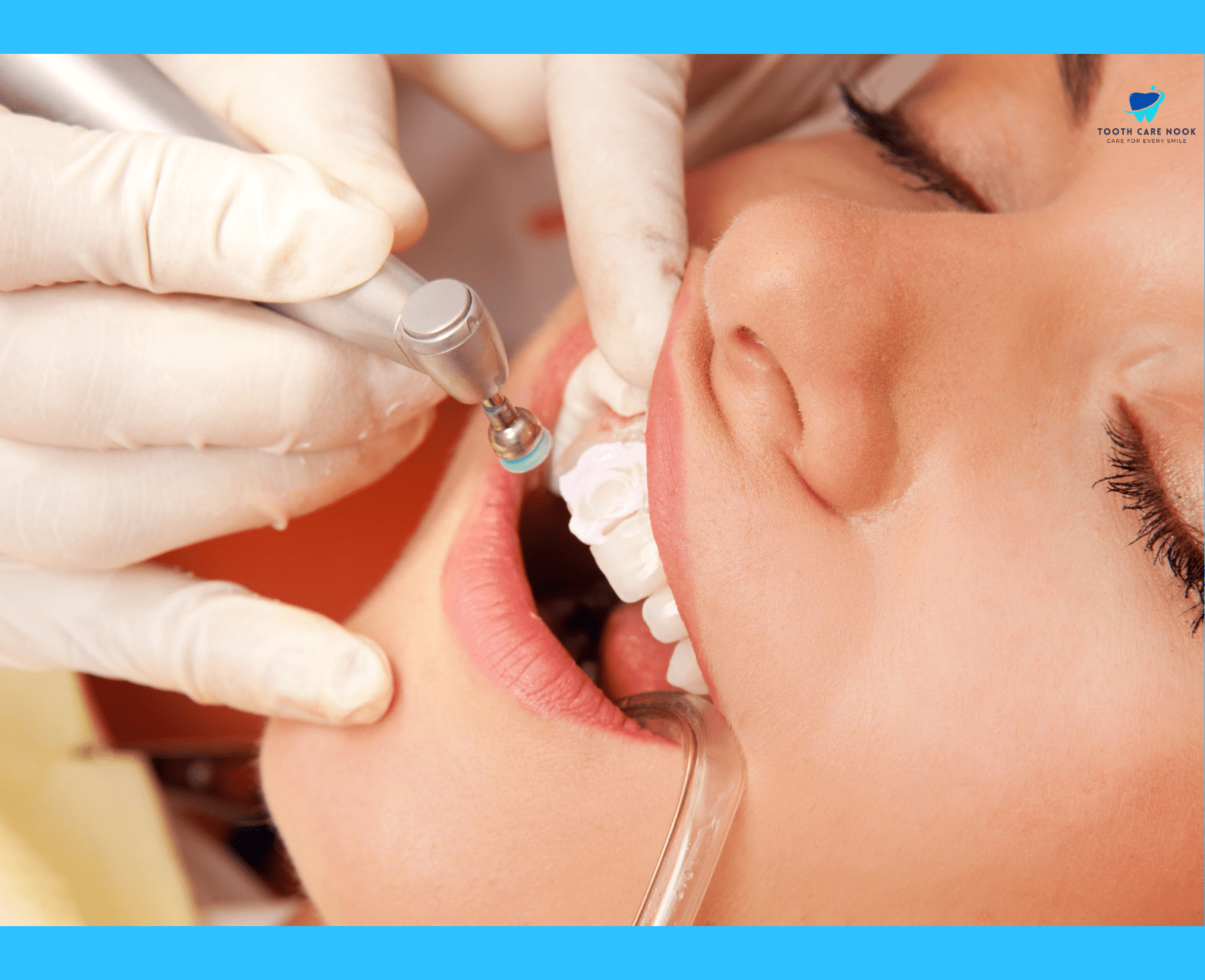 Treatment Options for Dental Chiclets 