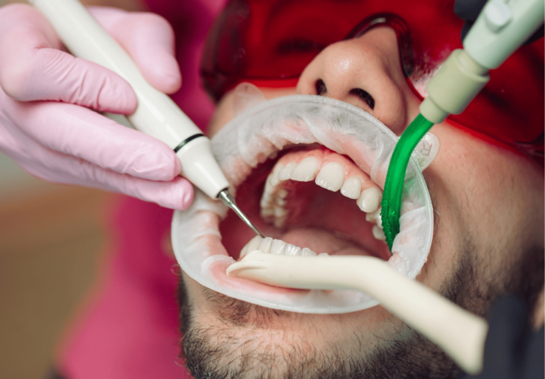 What Are The Disadvantages Of Deep Cleaning Teeth