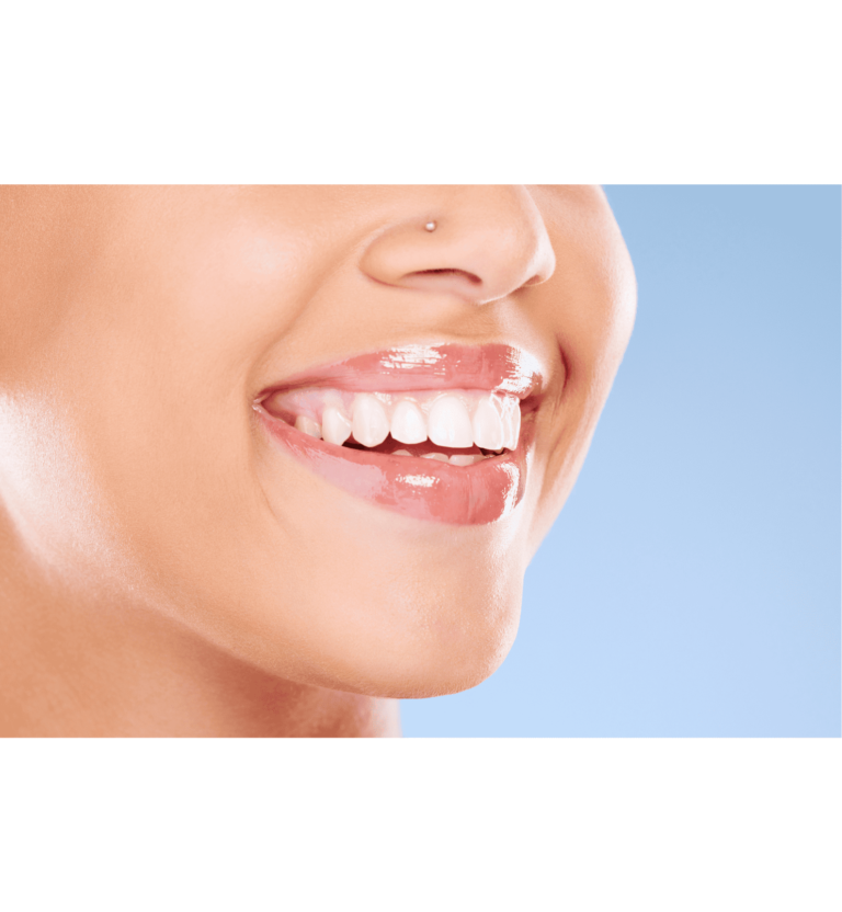 What is Internal Teeth Whitening