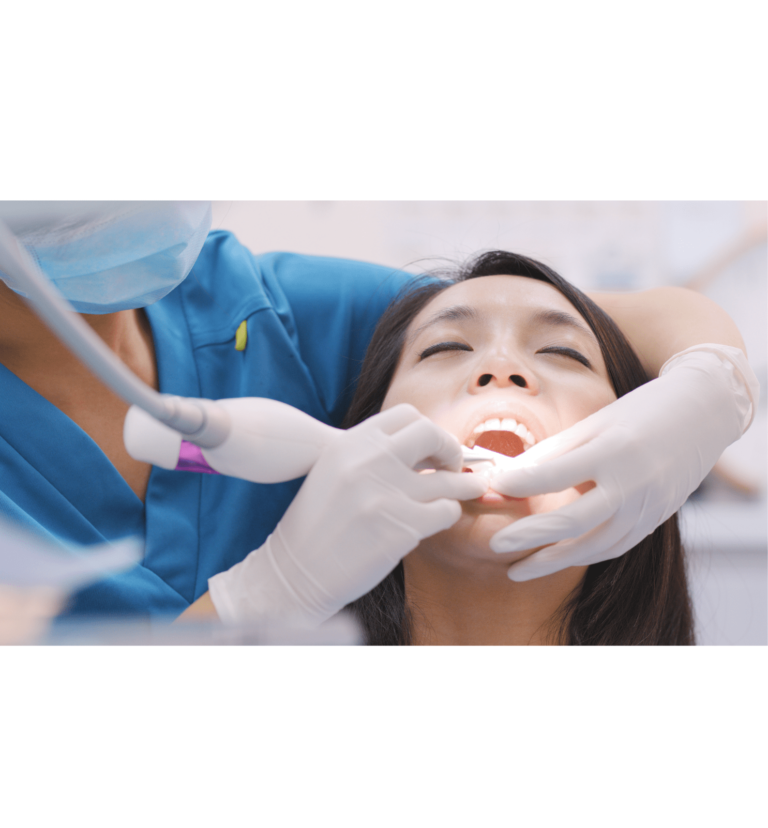 What is Ultrasonic Tooth Cleaning