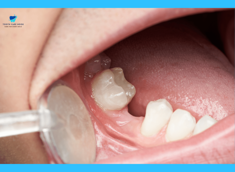 Signs Your Teeth Are Shifting - Causes, Symptoms, And All