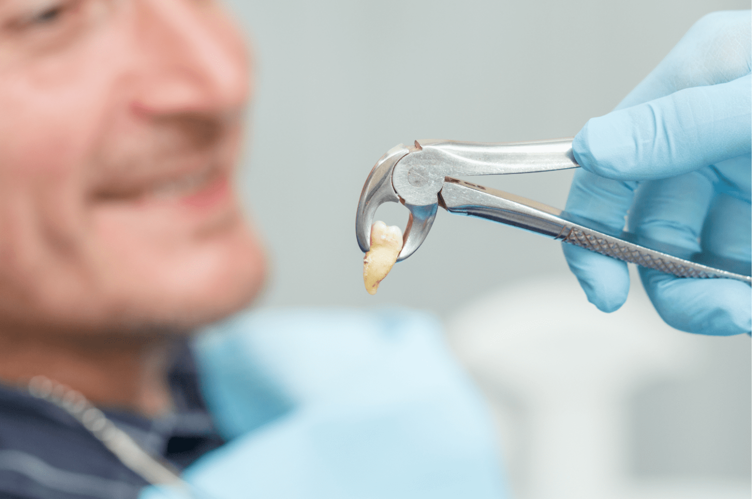 When Can I Workout After Wisdom Teeth Removal A Guide