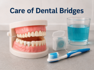 Caring of dental bridge 